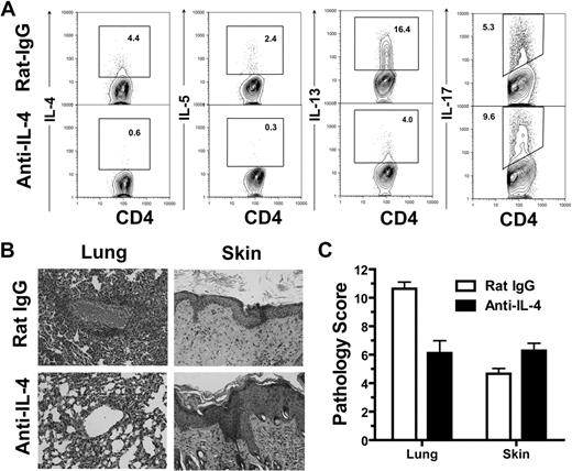 Figure 4. Absence of IL-4 and IFN-γ led to augmented Th17 differentiation and exacerbated damage in skin but not in lung. BALB/c recipients given IFN-γ−/− donor cells were treated with rat-IgG or anti–IL-4. (A) Intracellular cytokine profiles of splenic CD4+ T cells 13 days after HCT. Gated CD4+ T cells are shown in CD4 versus cytokines. Representative of 4 replicate experiments is shown. (B-C) H&E staining of lung- and skin-tissue sections of recipients 15 days after HCT and mean ± SE of histopathology scores (n = 8).