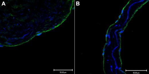 Figure 1. Two different antibodies show CADM1 immunofluorescent staining in venous endothelium. (A) Saphenous vein wall endothelium stained positively (green) with rabbit polyclonal anti-CADM1 antibody. (B) Saphenous vein valvular leaflet endothelium stained positively with chicken monoclonal anti-CADM1 antibody.