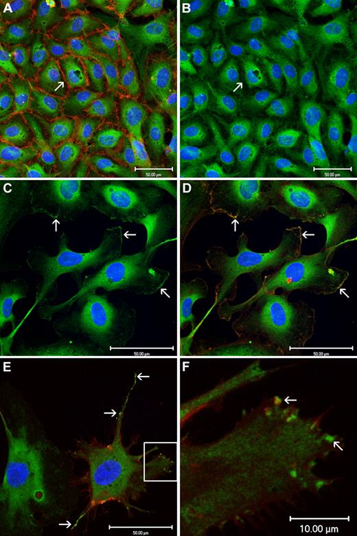 Figure 2. Confluent HUVECs show cytoplasmic but not membrane immunofluorescent staining for CADM1 with chicken monoclonal anti-CADM1. In contrast, migrating HUVECs show both cytoplasmic and membrane staining for CADM1 in lamellopodia and filopodia at the leading edge of cell migration. (A) Confluent HUVECs stained for CADM1 (green) and CD31 (red). CD31 clearly demarcates the intercellular boundaries. (B) Confluent HUVECs stained only for CADM1 show no evidence of membrane staining at the intercellular boundaries. (C) Migrating HUVECs show CADM1 staining in the cytoplasm and at the leading edge of lamellopodial membranes (white arrows). (D) The image in panel C counterstained with Phalloidin (red) shows colocalization of actin with CADM1 (combination appears yellow) at the leading edge of lamellopodial membranes (white arrows). (E) Migrating HUVECs stained for CADM1 (green) and CD31 (red) show CADM1 staining of filopodia colocalized at the membrane surface with CD31. CADM1 staining is present along the walls and at the leading edge of the filopodia. White arrows denote filopodia and boxed area a lamellopodia. (F) The boxed area of panel E at greater magnification shows the presence of localized high-intensity staining of CADM1 at the leading edge of a lamellopodia, some of which appears to be associated with developing filopodia.