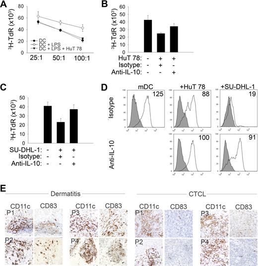 Figure 5. Malignant T cells inhibit DC maturation in an IL-10–dependent fashion. (A) Immature DCs (iDCs) were generated from monocytes and LPS (1 μg/mL) was added for the last 24 hours of culture to generate mature DCs (mDCs). A group of DCs was cocultured with HuT 78 cells 24 hours before LPS maturation. CD11c+ DCs were purified and iDCs, mDCs, or DCs that had been cocultured with HuT 78 cells before LPS maturation were used to stimulate proliferation of purified CD4+ T cells at the T-cell/DC ratios shown. (B-C) DCs were generated, matured with LPS, and used as stimulators in an allo-mixed lymphocyte reaction at a T-cell/DC ratio of 100:1. As in panel A, before maturation, groups of DCs were cocultured with either HuT 78 (B) or SU-DHL-1 (C) cells in the presence of an isotype control or neutralizing IL-10 monoclonal antibody (2 μg/mL), as indicated. Data are mean ± SD. (D) DCs were generated and matured with LPS in the presence or absence of HuT 78 or SU-DHL-1 cells, as indicated. An isotype control or neutralizing IL-10 antibody was included. Cells were stained with an isotype control (shaded) or anti-CD83 (solid line). Only CD11c+ cells were gated and included in the analysis. Mean fluorescent intensity (MFI) for CD83 is shown in each histogram. Data shown (A-D) are representative of at least 3 similarly performed experiments. (E) Benign dermatitis (n = 10) and CTCL (n = 10) skin biopsies were immunohistochemically stained for both CD11c and CD83. Four representative examples of each are shown.