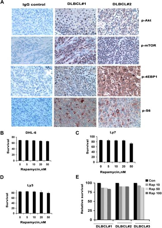 Figure 1. Activation of mTOR signaling in DLBCL. (A) Constitutive activation of the mTOR signaling pathway in patient samples of DLBCL. Activation of Akt, mTOR, S6rp, and 4EBP1 was assessed in DLBCL tissue by immunohistochemistry with phospho-specific antibodies for Akt mTOR or S6rp or 4EBP1. (B-E) Effect of rapamycin on DLBCL survival. After DHL-6, Ly7, and Ly3 cell lines (B-D) or primary cells from 3 DLBCL patients (E) were treated with the indicated concentrations of rapamycin for 48 hours, survival was assessed using annexin and propidium iodide followed by flow cytometry. Data from 1 representative experiment are shown for each cell line (n = 3). Bar graph shows mean ± standard deviation (SD) from 3 determinations.