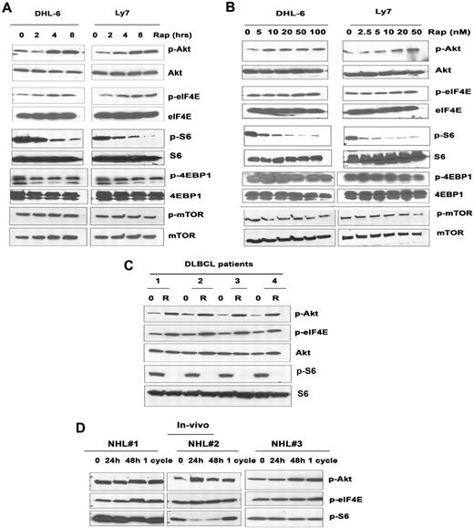 Figure 2. Effect of rapamycin on mTORC1/mTORC2 signaling. DHL-6 and Ly7 cells were treated with 50 nM rapamycin for 2, 4, and 8 hours (A) or for 24 hours (B) with the indicated rapamycin concentration. Phosphorylation of Akt, eIF4E, S6, 4EBP1, and mTOR was assessed by Western blot analysis. (C) Malignant cells from DLBCL patients (n = 4) were treated with 50 nM rapamycin for 6 hours before Akt, eIF4E, and S6 phosphorylation was analyzed by Western blot. (D) Levels of PAkt and p-eIF4E were evaluated in peripheral blood samples from 3 patients (n = 3) with aggressive lymphoma treated in the clinic with single-agent temsirolimus.