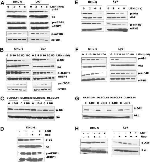 Figure 5. Effect of LBH on mTORC1 and mTORC2. (A-B) DHL-6 and Ly7 DLBCL lines were treated with 100 nM LBH for the indicated times (A) or with the indicated concentrations (B) of LBH for 24 hours and then subjected to Western blot analysis using p-S6 or p-4EBP1 or p-mTOR antibody. (C) Malignant cells from DLBCL patients (n = 4) were treated with 100 nM LBH for 6 hours and analyzed by Western blot. (D) DHL-6 cells were cotreated with 10 nM LBH and 10 nM rapamycin for 24 hours before S6 and 4EBP1 phosphorylation was analyzed. Effect of LBH on mTORC2 targets. (E-F) DHL-6 and Ly7 DLBCL lines were treated with 100 nM LBH for the indicated times (E) or with the indicated concentrations (F) of LBH for 24 hours and then analyzed for Akt or eIF4E phosphorylation. (G) Malignant cells from DLBCL patients (n = 4) were treated with 100 nM LBH for 6 hours and were analyzed for Akt or eIF4E phosphorylation. (H) DHL-6 and Ly7 cells were treated with 100 nM LBH and 20 nM rapamycin for 24 hours before analysis of Akt phosphorylation.