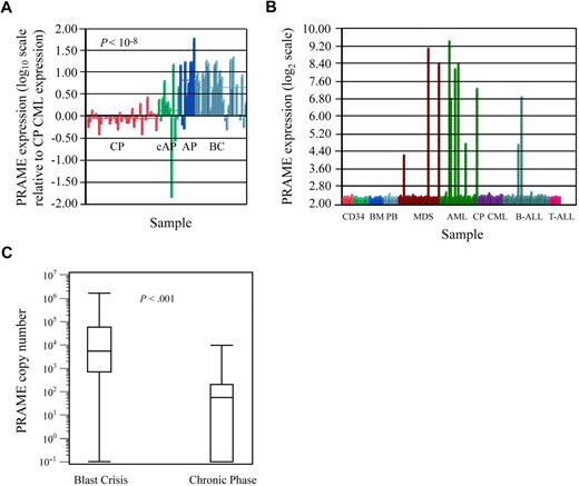 Figure 1. PRAME expression in leukemia cell lines and patient samples. (A) PRAME expression increases with CML disease progression. PRAME expression is shown as the log10 ratio of the normalized expression of PRAME in each patient sample compared with PRAME expression in a pool of CML CP samples. Red bars represent CP patients (n = 42); green bars represent patients with either AP disease by virtue of additional cytogenetic abnormalities (cAP; n = 7) or patients who returned to CP after treatment for BC disease (last 3); dark blue bars represent patients with AP disease by both cytogenetic and blast count criteria (n = 10); and light blue represents BC patients (n = 28). The difference between CP and BC is statistically significant (P << .001). (B) PRAME expression in normal and malignant hematopoietic cells. Normalized PRAME expression is shown on a log2 scale. PRAME was heterogeneously expressed in acute myeloid leukemia (AML) and myelodysplastic syndrome (MDS) patients with either refractory anemia with excess blasts or refractory anemia with excess blasts in transition. From left to right: CD34+ selected bone marrow (BM; red, n = 8), CD34+ selected peripheral blood stem cell products (light green, n = 10), unsorted BM (medium blue, n = 10), unsorted peripheral blood (light blue, n = 10), MDS (brown, n = 29), AML (green, n = 26), CP CML (purple, n = 17 independent cases from those shown in A), B-ALL (medium blue, n = 32), and T-ALL (pink, n = 7). (C) Quantitative PCR validation of PRAME expression in independent diagnostic BM samples from BC (n = 31) and early CP (n = 58) CML patients demonstrates increased expression in BC. Data are shown on a logarithmic (log10) scale. The line within each box represents the median; the upper and lower lines defining the box represent the 75th and 25th percentiles, respectively; and the lines outside the box extend to the maximum and minimum values (10−1 indicates undetectable PRAME expression). PRAME was expressed in all but 1 BC patient and in 50% of the CP patients. Mean expression was 9.0 × 104 copies (median, 5.5 × 104; range, 0 to 1.6 × 106 copies) in BC patients versus 560 copies (median, 200; range, 0 to 9.8 × 103 copies) in CP patients (P < .001).