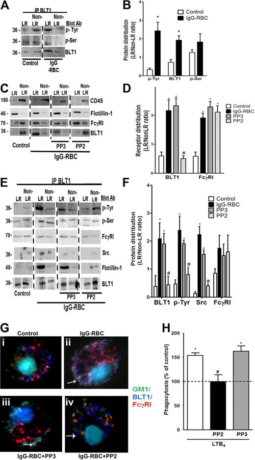 Figure 5. BLT1 phosphorylation by Src is required for IgG-induced FcγRI-BLT1 association in LRs. (A) AMs were incubated with or without 30:1 IgG-RBCs for 10 minutes and subjected to membrane fractionation. LR and non-LR membrane fractions were pooled and immunoprecipitated with an antibody against BLT1, after which immunoprecipitates were subjected to immunoblot analysis for the proteins shown on the right. (B) Relative distribution of total BLT1 as well as tyrosine- and serine-phosphorylated BLT1 was determined by densitometric analysis of immunoblots from 3 different experiments, as depicted in panel A, and is expressed as the LR/non-LR ratio of each. *P < .05 vs control. (C) AMs were pretreated with or without the Src kinase inhibitor PP2 (1 μM) or its negative control congener PP3 (1 μM) for 20 minutes, followed by incubation with or without 30:1 IgG-RBCs for 10 minutes. Pooled LR and non-LR fractions were prepared and subjected to immunoblot analysis for the proteins indicated at the right. (D) Relative distribution of BLT1 and FcγRI was determined by densitometric analysis of immunoblots from 3 different experiments, as depicted in panel C, and is expressed as the LR/non-LR ratio of each. *P < .05 vs control, and #P < .05 vs IgG-RBC. (E) AMs were incubated with or without PP2 or PP3 for 20 minutes, followed by challenge with 30:1 IgG-RBCs for 10 minutes. LR and non-LR membrane fractions were pooled and immunoprecipitated with anti-BLT1 antibody. The immunoprecipitates were subjected to immunoblot, as in panel A. (F) Relative distribution of total BLT1, tyrosine-phosphorylated BLT1, FcγRI, and Src was determined by densitometric analysis of immunoblots from 3 different experiments, as depicted in (E), and expressed as LR/non-LR ratio of each. *P < .05 vs control, and #P < .05 vs IgG-RBC. (G) AMs were pretreated with PP2 or PP3, followed by incubation with (ii-iv) or without (i) 10:1 IgG-RBCs for 10 minutes. Cells were fixed and stained with CTxB-Alexa 488/anti-CTxB, Alexa 647 mouse anti-BLT1, and phycoerythrin mouse anti-FcγRI primary antibodies, and then visualized by confocal microcopy. Yellow patches signify areas of colocalization of FcγRI and GM1; purple patches, colocalization of FcγRI and BLT1; and white/gray patches, colocalized BLT1, FcγRI, and GM1 (the latter indicated by solid arrows). A dashed arrow pointing to a blue dot indicates BLT1 alone. Results are representative of at least 3 independent experiments. (H) AMs were pretreated for 5 minutes with vehicle control or PP2 or PP3 (100 nM), followed by 5-minute incubation with or without 10 nM LTB4. They were then incubated with IgG-RBCs (50:1), and phagocytic indices were determined as described in “Methods.” Phagocytosis is expressed as the percentage of the control value (IgG-RBCs alone) to which no drugs were added, and each bar represents the mean ± SEM from 3 individual experiments, each performed in quintuplicate. *P < .05 vs control, and #P < .05 vs LTB4.