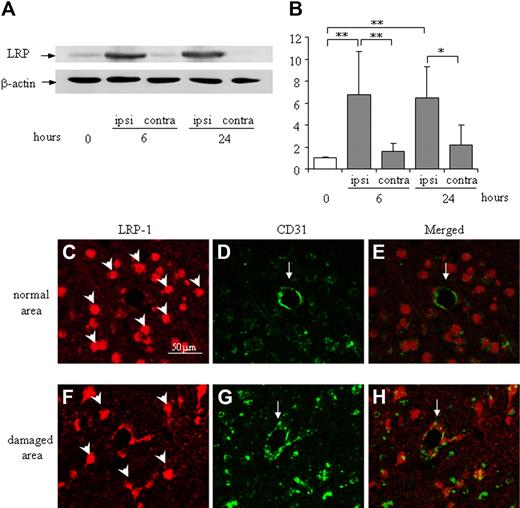 Figure 4. Expression and localization of LRP in the damaged cortex of the mouse brain after MCA occlusion. (A) Representative immunoblots against LRP and β-actin as an internal control are shown. The expression of LRP is up-regulated in the ipsilateral hemisphere at 6 and 24 hours after MCA occlusion, whereas it is not changed in the contralateral hemisphere. (B) Quantitative data are shown as fold increase. Data are mean ± SD of 6 experiments. *P < .05; **P < .01. ipsi indicates ipsilateral hemisphere; contra, contralateral hemisphere. The time after MCA-O is indicated in hours. Localization of LRP in the normal area (C-E) or the damaged border area (F-H) at 24 hours after MCA-O is shown by immunofluorescence microscopy. In the normal area, LRP immunoreactivity (red: rodamine) localized at neuron-like cells (arrowheads in panel C) but not at CD31 (green: fluorescein) positive endothelial cells (arrows in panels D-E). At the damaged border area, it localized at both globular cells (arrowhead in panel F) and CD31-positive endothelial cells (arrow in panels G-H). The scale bar represents 50 μm.
