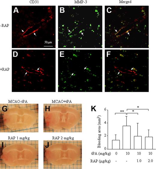 Figure 5. Effect of RAP on up-regulation of MMP-3 expression and increased ICB induced by t-PA treatment after MCA occlusion in mice. Immunohistochemical analysis of MMP-3 and CD31 expression (A-F). MMP-3 immunoreactivity (green: fluorescein) colocalizing with CD31 immunoreactivity (red: rodamine) at the border zone of the damaged brain after t-PA treatment without (A-C) or with (D-F) RAP pretreatment. The arrows represent endothelial cells, and the scale bar represents 50 μm. Representative pictures are shown of a damaged brain section after MCA-O without t-PA treatment (G), with t-PA treatment (H), with t-PA and 1 mg/kg RAP (I), or with t-PA and 2 mg/kg RAP (J). (K) Quantitative data are also shown. Data represent mean ± SD of 8 experiments. *P < .05; **P < .01.