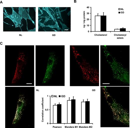 Figure 3. Cholesterol content and lactosylceramide trafficking. (A) MSCs stained with filipin and observed under a fluorescence microscope; scale bar = 20 μm. (B) Total cholesterol and cholesteryl ester content expressed as nanograms per milligrams of total protein content in the samples. (C) Lysosomes (stained with Lyso Tracker Red) and BODIPY-lactosylceramide (green) after 2 hours of trafficking, with corresponding signal overlap in white, and correlation coefficients in the graph (Manders M1 corresponds to the correlation of the green signal on the red signal, Manders M2 is red on green); scale bar = 20 μm. All error bars represent 1 SD.