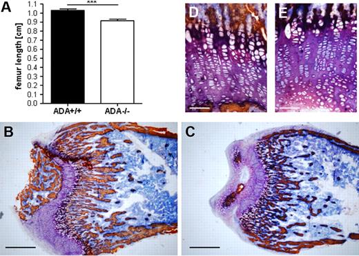 Figure 2. Reduced longitudinal growth and trabecular bone in ADA−/− mice. (A) ADA−/− femora and tibiae (not shown) are significantly shorter compared with wild-type (cm). ***P < .001. Metaphyseal bone sections of ADA+/+ (B) and ADA−/− (C) femora (original magnification ×2.5). Scale bar represents 600 μm and original magnification ×20 of ADA+/+ (D) and ADA−/− (E). Scale bar represents 50 μm; indicates defects in ossification but not in cartilage formation. Histomorphologic analyses were performed on ADA+/+ (n = 5) and ADA−/− (n = 5) femora. BV TV indicates trabecular bone volume (%); Tb Th, trabecular thickness (μm); Tb N, trabecular number (1/mm); Tb S, trabecular separation (mm).