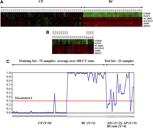 Figure 3. Differential gene expression of the 6-gene signature in patient cases. Heatmaps of the 6-gene signature selected by the iterative BMA algorithm. (A) Heatmap of the gene expression of the 6-gene signature in the training set of CP and BC CML cases using microarray-based gene expression analyses. (B) Heatmap of the gene expression in the test set, also by microarray-based gene expression analyses. This group is made up of AP by cytogenetic criteria only (AP cyto); AP by cytogenetic and blast count criteria (AP); and BC after a return to second CP (BC-rem). Green indicates differentially decreased expression of each gene in each case compared with its expression in a pool of CP patient samples and red indicates differentially increased expression. The more saturated the color, the greater is the degree of differential expression. (C) A graphic depiction of the predicted posterior probability of all patient samples is shown. The samples are represented on the horizontal axis, whereas the predicted probabilities are represented on the vertical axis. For the training data consisting of 72 CP (group 0) and BC (group 1) cases, the average predicted probabilities over 100 cross validation runs are shown. For the test data, composed of 21 patients before allogeneic transplantation, the predicted probabilities of the 6 signature genes averaged over 21 models are shown. This “intermediate phase” test set is composed of group 2 AP by cytogenetic criteria only; group 3 AP by cytogenetic and blast count criteria; and group 4 BC after a return to second CP. For 17 of 21 patients, posttransplantation outcomes were available. Using a posterior probability threshold of 0.3, we found that 7 of 11 patients with predicted posterior probabilities ≥ 0.3 died of relapse or treatment-related mortality after transplantation versus only 1 of 6 with a predicted posterior probability < 0.3 (OR = 9).