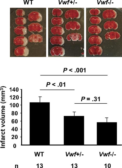 Figure 1. Level of VWF regulates infarct volume after ischemic stroke in mice. Representative TTC stain of coronal brain sections of 1 mouse for each strain 22 hours after MCAO (top) and brain infarct volumes (bottom) in WT, VWF+/−, and VWF−/− mice. Deficiency or heterozygosity of VWF resulted in a significant decrease in infarct volume compared with WT.