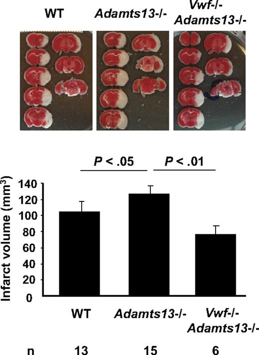 Figure 2. ADAMTS13 regulates infarct volume after ischemic stroke in mice. Representative TTC stain of coronal brain sections of 1 mouse for each strain 22 hours after focal cerebral ischemia in WT, Adamts13−/−, and Adamts13−/−/VWF−/− (top) and corresponding brain infarct volumes quantification (bottom). Increase in infarct volume in Adamts13−/− mice, compared with WT, depended on the presence of VWF.