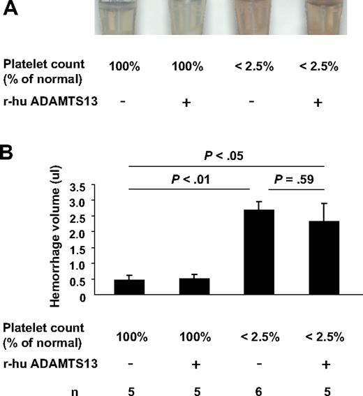 Figure 6. Effect of r-hu ADAMTS13 infusion on intracerebral hemorrhage after stroke in thrombocytopenic mice and mice with normal platelet count. (A) Supernatants of right (injured) hemisphere homogenates. (B) Hemorrhage volume as determined by hemoglobin brain tissue analysis. Hemoglobin level (corresponding to a volume of blood in μL) was determined in the right infarcted hemisphere. The levels of hemoglobin from the right hemispheres with normal platelet count were low (the same as in the noninjured left hemispheres whether platelet depleted or not depleted; not shown). In contrast, hemorrhage was significant in the right hemispheres of platelet-depleted mice. Infusion of r-hu ADAMTS13 did not affect the hemorrhage volume.
