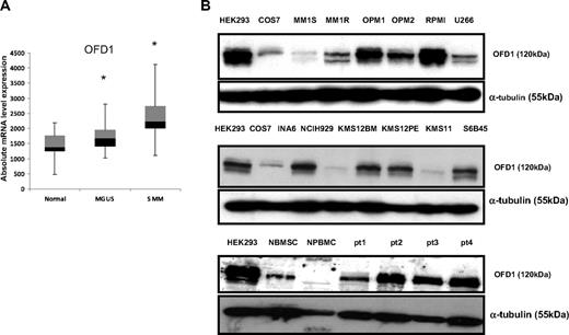 Figure 2. OFD1 expression in MM cell lines and primary patient cells. (A) Quantitative mRNA expression level of OFD1 in plasma cells from healthy persons (n = 22), as well as MGUS (n = 44) and MM (n = 12) patients. Box plots define the median values, 25% to 75% of values around the median, and the range of values. *Statistically significant difference among the groups (P < .05). (B) Western blot analysis of OFD1 in MM cell lines and primary patient cells. OFD1 protein expression was analyzed in 12 MM cell lines (MM1s, MM1r, OPM1, OPM2, RPMI8226, U266, INA6, NCIH929, KMS12BM, KMS12PE, KMS11, S6B45), primary tumor cells from 4 MM patients, as well as BMSCs and PBMCs from healthy donors. Levels of OFD1 protein expression are compared with HEK293 and COS7 as positive controls for OFD1 expression.