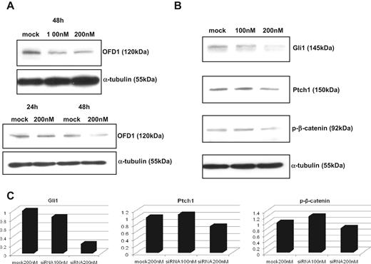 Figure 3. OFD1-specific knock-down with siRNA in MM1S cells. (A) OFD1 knock-down with specific siRNA in MM1S cells reveals a time-dependent, but dose-independent, inhibition of OFD1. (B) OFD1-specific inhibition leads to a down-regulation of Hh- and Wnt-related genes at 48 hours. (C) The levels of expression of Gli1, Ptch1, and p-β-catenin proteins, after OFD1-specific knock-down, were quantitated by densitometry and normalized with tubulin.