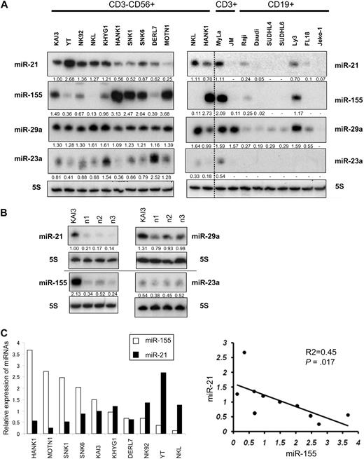 Figure 1. Northern analysis of miR-21, miR-23a, miR-29a, and miR-155 in NK-cell lymphoma/leukemia lines. (A) Northern analysis of miR-21, miR-23a, miR-29a, and miR-155 in 10 NK-cell (CD3−CD19−CD56+; left panel), 2 T-cell (CD3+CD19−CD56−; right panel), and 7 B-cell (CD3−CD19+CD56−; right panel) lymphoma/leukemia lines. NKL and HANK1 are shown in both panels in duplicate to compare miRNA expressions. Fold changes in miRNA were determined by densitometry and are shown below the gels after normalization to the level of miR-21 in KAI3 cells, which was assigned a value of 1.00. The blots for all 4 membranes hybridized by γ32-dATP-antisense oligo for microRNAs were exposed at the same condition (see “Methods”). (B) Expression of miR-21, miR-23a, miR-29a, and miR-155 measured in 3 samples of normal cells (n1, n2, and n3) expressing sCD3−CD56+. The level of miR-21 expression in KAI3 cells was assigned a value of 1.00. (C) Correlation between miR-21 and miR-155 expression. In the left panel, □ and ■ depict relative expression values for miR-155 and miR-21 expression, respectively. In the right panel, y-axis, expression values for miR-21 expression; x-axis, expression values for miR-155 expression. The P value was calculated by simple regression analysis.