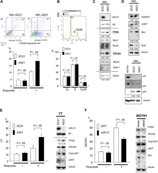Figure 4. Targets of miR-21 and the function in NK-cell lymphoma/leukemia. (A) Apoptosis among NKL cells. ASO-21– and SCO-21–treated cells were exposed to 100 μmol/L etoposide for 4 hours. Top panels show flow cytometric analysis of ASO-21–treated and SCO-21–treated NKL cells: y-axis, cells stained by propidium iodide (PI); x-axis, cells stained by annexin V–FITC. Apoptotic cells are in Regions 1 (R1) and 2 (R2). Apoptotic (R1 + R2) cells of ASO-21–treated cells are showing significantly greater percentages than those cells treated with SCO-21. Bottom panel shows the percentages of apoptotic cells (R1 + R2). □ and ■ depict percent apoptosis (R1 + R2) among NKL cells treated with SCO-21 and ASO-21, respectively. Symbols and bars indicate means and SDs of triplicate samples. (B) Cell-cycle analysis for NKL cells treated with ASO-21 or SCO-21. In the top panel, red lines show the cell-cycle pattern of cells treated with SCO-21, whereas green lines show the cell-cycle pattern of those treated with ASO-21. G1, S, and G2/M phases are shown as described. Average (n = 3) percentages among SCO-treated NKL cells: G1, 29.3%; S, 61.3%; and G2/M, 9.4%. Average (n = 3) percentages among ASO-treated NKL cells: G1, 25.3%; S, 66.5%; and G2/M, 8.2%. (C) Western analysis for direct candidate targets of miR-21 of NKL cell line treated with ASO-21 and SCO-21. Northern blot analysis of miR-21 in NKL cells treated with ASO-21 and SCO-21 are also shown. Fold changes in proteins expression are shown below the gels and normalized to the level in NKL SCO-21 treated cells, which are assigned a value of 1.00. (D) Western analysis for candidate downstream targets of miR-21 of NKL cell line treated with ASO-21 and SCO-21. Fold changes in proteins expression are shown below the gels and normalized to the level in NKL SCO-21–treated cells, which are assigned a value of 1.00. Bottom panel shows an immunoblot analysis of p21, p27, and p53 in NKL cells treated with ASO-21 or SCO-21. (E) Incidence of apoptosis among YT cells. In the left panel, cells treated with ASO-21 or SCO-21 were exposed to 100 μmol/L etoposide for 4 hours. □ and ■ depict percent apoptosis among YT cells treated with SCO-21 and ASO-21, respectively. Symbols and bars indicate means and SDs of triplicate samples. Apoptotic cells of ASO-21–treated cells show significantly greater percentages than those cells treated with SCO-21. In the right panel, Western analysis of miR-21 targets in YT cells treated with ASO-21 or SCO-21. Fold changes in protein expression are shown below the gels and normalized to the level in SCO-21–treated cells, which was assigned a value of 1.00. (F) Incidence of apoptosis among transduced MOTN1 and control cells. In the left panel, MOTN1 cells transduced with miR-21 plus GFP or GFP alone (control) were exposed to 100 μmol/L etoposide for 4 hours. □ and ■ depict percent apoptosis among GFP-transduced (control) and miR-21–transduced cells, respectively. Symbols and bars indicate means and SDs of triplicate samples. Apoptotic cells of miR-21 transduced cells show significantly lower percentages than those of control cells. In the right panel, Western analysis of PTEN, pAKT, total AKT, and Bim expression in MOTN1 cells. Fold changes in protein expression are shown below the gels and are normalized to the level in GFP-transduced control cells, which was assigned a value of 1.00.
