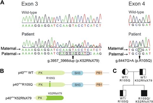 Figure 3. Analysis of NCF4 and patient pedigree. (A) Chromatograms corresponding to the wild-type and patient sequences in NCF4 exons 3 and 4. The alleles present in the mother and father are as indicated; nucleotides that are duplicated in 3957_3966dup (exon 3) and the point mutation g.6263G>A (exon 4) are outlined by a black line. Nucleotide positions are based on the gDNA sequence, reported as the NCBI Reference Sequence number NC_000022.37 (B) Location of the NCF4 mutations in a schematic of p40phox. Amino acid positions are based on NCBI Reference Sequence number NP_000622 (from NM_000631; for isoform 1, containing 339 amino acids).37 Predicted functional domains shown include a PX (phagocyte oxidase homology) domain (position 19 to 140), SH3 domain (position 175 to 225), and PB1 (phagocyte oxidase and Bem1p) domain (position 285 to 306).2 (C) Pedigree of the patient's family. Squares represent male family members and circle, the female family member; genotypes for the NCF4 alleles at the protein level are shown.
