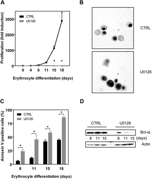 Figure 2. MEK activity is essential for the survival of hematopoietic progenitors during erythropoiesis. CD34+ progenitors were differentiated toward erythrocytes for 18 days either in the presence or in the absence of 5 μM U0126. (A) Expansion was determined by counting the trypan blue–negative cells. (B) After 18 days of culture, cytospins were prepared and stained with May-Grünwald-Giemsa solution. (C) During the 18-day culture period, the percentage of apoptotic cells was determined by annexin V staining. Results are presented as means of 4 independent experiments. Error bars represent SEMs. (D) Protein lysates were prepared from CD34+ cells differentiated toward erythrocytes for 8, 11, and 15 days in the presence or absence of 5 μM U0126. Western blot analysis was performed with an antibody against Bcl-xL (top) or β-actin (bottom) as a control for equal loading. Similar results were obtained in 3 independent experiments.