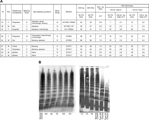 Figure 1. Phenotypic data for patients and family members. (A) Table showing laboratory results. Reference values are given for each assay. Ratios of antigen to activity are shown alongside activity columns. VWF indicates von Willebrand factor; Ag, antigen; RCo, ristocetin cofactor activity; CB, collagen-binding activity; and WT, wild type. Bleeding scores were calculated using the condensed MCMDM-1VWD questionnaire. (B) Gels showing VWF multimer pattern from plasma samples. Gray bars are placed to maintain patient confidentiality. Patient ID or type of control is shown at the bottom of each lane. A sample from 3J was not available for electrophoresis.
