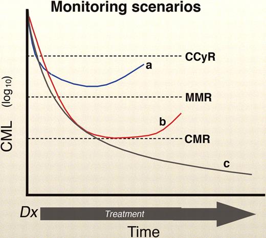 Figure 2. Monitoring scenarios. The “a” curve shows a patient in a CCyR, but without a MMR, with a rising BCR-ABL. This is a worrisome case that demands close follow-up (Figure 3). Curve “b” show a patient with a CCyR and a MMR, with a rising BCR-ABL. This case requires follow-up, but not necessarily major concern, unless the rise continues, especially with a resistant mutation. Lastly, curve “c” shows a luck patient with the best of circumstances: a CCyR, MMR, and a stable or declining BCR-ABL. Professional illustration by Marie Dauenheimer.