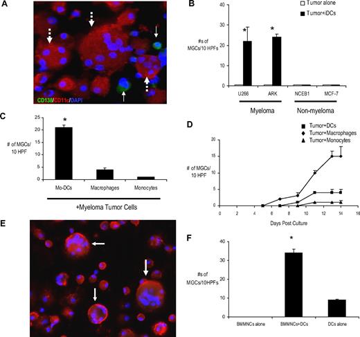 Figure 1. Myeloma promotes MGC formation by inducing cell fusion in human dendritic cells. (A) Immunofluorescense analysis of MGCs in tumor-DC cocultures. Myeloma cells (U266) were plated with or without monocyte-derived DCs at a tumor/DC ratio of 1:100 in methylcellulose cultures. Cells were harvested for cytospins after an incubation of 2 weeks. Slides were acetone-fixed and stained for CD138 (green), CD11c (red), and DAPI (blue). MGCs were counted in 10 random high-power fields. Shown is a representative area with 3 CD138−CD11c+ giant cells with varying numbers of nuclei (dotted arrows) and CD138+ tumor cells (thin arrows). Original magnification, ×40. (B) Myeloma (U266 and ARK), breast cancer (MCF-7) or mantle cell lymphoma cell line (NCEB1) were plated with and without DCs at a ratio of 1:100 in methylcellulose cultures. Cells were harvested for cytospins after an incubation of 2 weeks. Slides were acetone-fixed and stained for CD138, CD11c, and DAPI as described in panel A. The numbers of MGCs were counted in 10 random high-power fields (HPF). Results are the mean ± SEM of 3 separate experiments. *P < .05. (C) Myeloma cells (U266) were plated with either monocytes (Monocytes), GM-CSF–treated monocytes (Macrophages), or immature DCs (Mo-DCs) cultured from the same donor at a tumor/myeloid cell ratio of 1:100 in methylcellulose cultures. Cells were harvested for cytospins after 2 weeks. Slides were acetone-fixed and stained as described previously. Numbers of MGCs were counted in 10 random HPF. Results are the mean ± SEM of 3 separate experiments for the cell line. *P < .05. (D) Kinetics of MGC formation in the experimental conditions in panel C were monitored by microscopy. *P < .05. (E) Bone marrow mononuclear cells (BMMNCs) from a myeloma patient were cocultured with DCs in methylcellulose cultures at a tumor/DC ratio of 1:100. Cytospins were made after an incubation of 2 weeks. Slides were acetone-fixed and stained for CD138, CD11c, and DAPI and counted for MGCs (arrows) as described previously. Data are representative of similar experiments on 3 separate patients. Original magnification, ×20. (F) Enumeration of MGCs in BMMNC + DC cocultures from a representative myeloma patient is shown. Data are representative of similar experiments on 3 different patients. BMMNCs alone and DCs alone were used as controls.