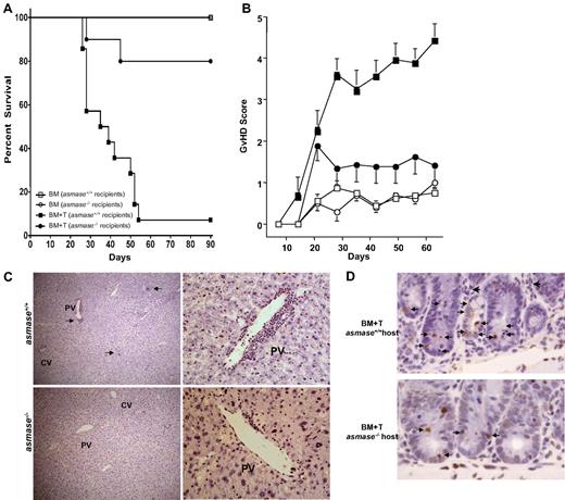 Figure 1. Host ASMase regulates graft-versus-host–associated morbidity, mortality, and target organ injury. Lethally irradiated (1100 cGy) C57BL/6asmase+/+ or C57BL/6asmase−/− mice received intravenous injection of LP TCD-BM cells (5 × 106) with or without splenic T cells (3 × 106). (A) Kaplan-Meier survival and (B) clinical GVHD score derived from weekly assessment of 5 clinical parameters (weight loss, hunched posture, decreased activity, fur ruffling, and skin lesions) are shown representing 6 to 8 BM control and 13 or 14 BM + T-cell recipients per group compiled from 2 experiments. Statistical analysis is as follows: (A) BM (asmase+/+ hosts) versus BM + T (asmase+/+ hosts), P < .001; BM + T (asmase+/+ hosts) versus BM + T (asmase−/− hosts), P < .001. (B) BM (asmase+/+ hosts) versus BM + T (asmase+/+ hosts)j P < .005; BM + T (asmase+/+ hosts) versus BM + T (asmase−/− hosts)j P < .005. (C) C57BL/6asmase+/+ or C57BL/6asmase−/− mice received transplants as described in Figure 1 and were killed 21 days thereafter for histopathologic analysis. Representative 5-μm hematoxylin and eosin–stained liver sections reveal increased lymphocyte infiltration (arrows) around the central and portal veins and destruction of hepatic architecture in asmase+/+ hosts receiving allogeneic T cells compared with asmase−/− littermates (left panels). Images were acquired using Zeiss Plan-NEOFLUAR 5×/0.3 numeric aperture (NA) dry lens (Carl Zeiss Inc) and QImaging camera model Retiga EX, and were processed with Improvision Volocity software (PerkinElmer) and Adobe Photoshop Version 7.0 software (Adobe Systems). Right panels reveal higher magnification images of typical endotheliitis observed around a portal vein in asmase+/+ (top panels) but not asmase−/− (bottom panels) hosts. Images were acquired as in left panels, using a Zeiss Plan-NEOFLUAR 40×/1.3 NA oil DIC lens. (D) Representative 5-μm TUNEL-stained sections of proximal jejunum crypts displaying epithelial apoptosis. Images were acquired as in panel C, using a Zeiss Plan-NEOFLUAR 40×/1.3 NA oil DIC lens. Small arrows indicate cells containing condensed or fragmented brown nuclei contrasting with the blue stain of nonapoptotic nuclei, quantified in panel E. Large arrows indicate areas of inflammatory cell infiltration. Crypt apoptosis (E) was scored in 200 crypts per point. Data (mean ± SEM) are collated from 2 experiments. Frequency histograms of apoptotic cells in the villus lamina propria (F) represent data from 150 villae per point, collated from 2 experiments. (G) C57BL/6 recipient hosts received marrow transplants as detailed earlier in the Figure 1 legend, and skin (tongue and ear) was harvested 21 days thereafter. Alternatively, skin was harvested 14 days after transplantation of 10 × 106 TCD-BM cells with or without 0.5 × 106 T cells from B10.BR (H2k) donors. Skin GVHD score was determined by the number of dyskeratotic apoptotic keratinocytes per millimeter of epidermis (mean ± SEM) as assessed in blinded fashion on hematoxylin and eosin–stained sections. Data represent 4 to 14 mice per group compiled from 3 independent experiments.