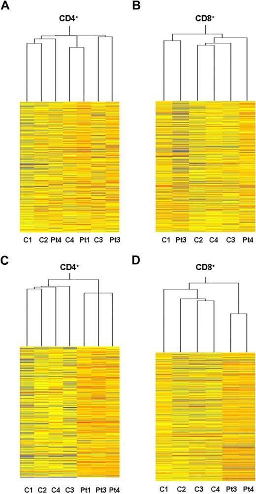Figure 1. Gene expression profile in purified T-cell subset from GT-treated patients. Heat maps representing the unsupervised Affymetrix gene expression analysis of PB CD4+ (A) and CD8+ (B) T cells isolated from 3 GT-treated patients (patient 1, +30 months; patient 3, +26 months; patient 4, +10 months) and 4 age-matched healthy controls (C). Expression levels are represented by a color key in which bright red represents the highest levels (up-regulated genes) and bright blue represents the lowest levels (down-regulated genes); less saturated shades represent intermediate levels of expression. Heat maps resulting from supervised hierarchical clustering of CD4+ (C) and CD8+ (D) T-cell samples according to the type of treatment (ie, GT vs normal controls). P value cutoff = .05; multiple testing correction, none. This restriction tested 9364 genes. Approximately 4682 genes would be expected to pass the restriction by chance.