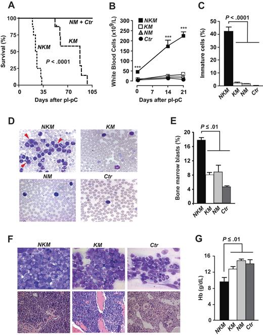 Figure 1. Survival and analyses of white blood cells and hemoglobin levels of NKM and control mice. (A) Kaplan-Meier survival plots for NKM (n = 8), KM (n = 8), NM (n = 6), and Ctr mice (n = 6). (B) White blood cell counts of NKM, KM, NM, and Ctr mice (n > 8 in each group). ***P < .001. (C) Percentage of immature white blood cells in peripheral blood of NKM (n = 4), KM (n = 3), NM (n = 3), and Ctr (n = 3) mice 3 weeks after pI-pC injections. (D) Photographs of typical blood smears evaluated in panel C (original magnification, ×100; 1.30 NA oil objective). Arrowheads indicate myeloblasts. (E) Percentage of blasts was evaluated in BM smears from NKM (n = 3), KM (n = 3), NM (n = 3), and Ctr (n = 2) mice 3 weeks after pI-pC injections. (F, top panels) Photographs of typical bone marrow smears (May-Grünwald-Giemsa staining) evaluated in panel E (original magnification ×100; 1.30 NA oil objective). (Bottom panels) Photographs of sternum sections (hematoxylin and eosin staining; original magnification ×63; 1.40 NA oil objective). (G) Blood hemoglobin concentrations of mice shown in panel B 3 weeks after pI-pC injections. Data are mean and SEM; survival was assessed by the log-rank test; other statistics, 1-way analysis of variance and Tukey posthoc test for multiple comparisons. Images in panels D and F were obtained with an AxioCam camera mounted on an Axioplan 2 microscope and the AxioVision software (release 4.3; Zeiss).