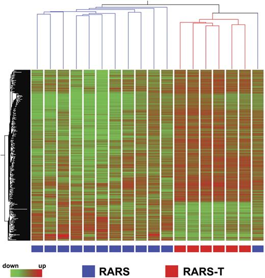 Figure 4. Gene expression profiles of CD34+ cells. Hierarchical clustering of the differentially expressed genes between the CD34+ cells from 6 patients with RARS-T (red symbols under profiles) and the CD34+ cells from 12 patients with RARS (blue symbols under profiles). Each row represents a single Affymetrix probe set, and each column represents a separate patient sample.