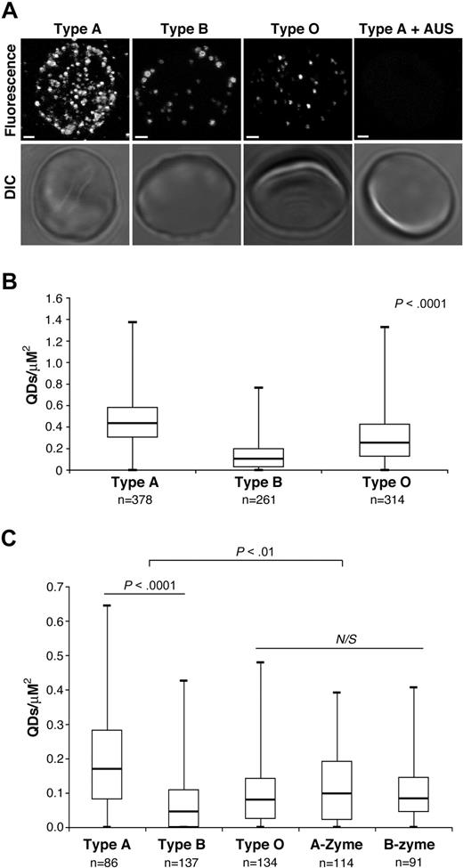 Figure 1. Blood group status affects Siglec-2-Fc-QDs binding to Sias on RBCs. (A) Top panel: each Siglec-2-Fc-QD complex appears as a single bright dot on the cell surface. Sialidase treatment (AUS; right panel) abolishes Siglec-2-Fc-QD binding to RBCs; type A RBC is shown as an example. Bottom panel: brightfield image of each cell. Bar represents 1 μM. (B) Box plot of Siglec-2-Fc-QD–binding density on RBCs from 3 type A, 3 type B, and 4 type O volunteers. Binding density was unique to each blood type (P < .0001). (C) Representative results for a single volunteer from each blood group are shown. Enzymatic treatment of type A and B RBCs with A-Zyme (α-N-acetylgalactosaminidase) and B-Zyme (α-d-galactosidase), respectively, changes Siglec-2-Fc-QD density (P < .01) to resemble type O. Statistical significance was determined by an unpaired, 2-tailed t test. n = Number of cells in each group; N/S = not significant. Box plot: Box shows the quartile 25 to quartile 75 range, the line represents the median value, and whiskers show the minimum and maximum values. Images were acquired with Olympus FV1000 confocal microscope. Z-sections were done at 0.15-μM steps. Image analysis and 3-dimensional reconstruction were done with ImagePro Plus software (Media Cybernetics) and ImageJ 1.33K software (NIH).