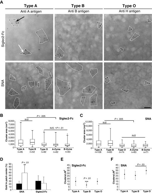 Figure 4. Siglec-2-Fc and SNA form clusters on RBC membrane. (A) Electron micrographs of Siglec-2-Fc (top panel) and SNA (bottom panel) on plasma membranes of RBCs. Siglec-2-Fc and SNA were both detected using QD655-conjugated secondary antibody (gray ovals, indicated by black arrow). The membranes were also labeled with A-, B-, and H-specific antibodies, detected with gold 5-nm–conjugated secondary (black dots, indicated by white arrow). Siglec-2-Fc and SNA bound the membranes in defined patches. The area of these patches was calculated using ImageJ 1.33 (NIH) software, by marking a polygon around each patch. The software calculated the area and center of mass for each polygon. The distance between each A and B antigen associated with the cluster center was easily derived. Bar indicates 50 nm. (B-C) Box plot of the area of Siglec-2 and SNA clusters, respectively. Enzymatic treatment of type A and B RBCs with A- and B-Zyme, respectively, reduced Siglec-2 and SNA cluster size significantly (P < .005) to resemble type O. (D) The percentage of A antigen (■) and B antigen (□) localized in the patch center. Error bars indicate SD. (E-F) Number of clusters per μM2 was calculated for Siglec-2-Fc and SNA, respectively. The number of Siglec-2-Fc clusters on blood type B membranes was reduced by 58% compared with type A (P = .01) and 43% compared with type O (P = .002). Average ± SD is shown. Statistical significance was determined by an unpaired, 2-tailed t test. N/S = not significant. Images were acquired with Philips CM10 transmission microscope.