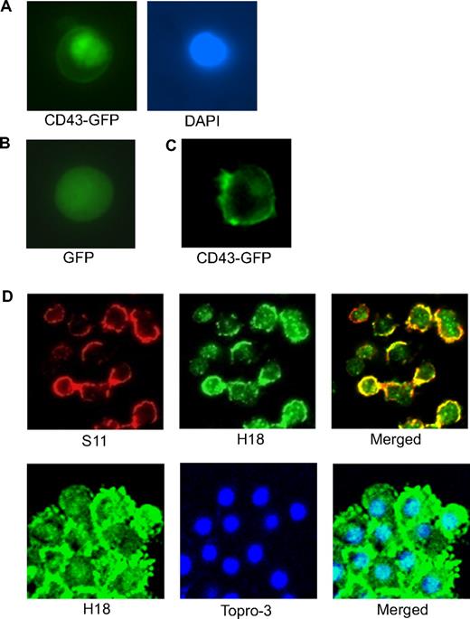 Figure 4. CD43ct is localized in the nucleus. (A) Fluorescent microscopy of CD43-deficient bone marrow cells infected with CD43-GFP. DAPI (4,6 diamidino-2-phenylindole) staining shows the location of the nucleus. (B) Fluorescent microscopy of CD43-deficient bone marrow cells infected with GFP alone as a control. (C) Fluorescent microscopy of CD43-deficient macrophages infected with CD43-GFP. (D) Confocal microscopy of total bone marrow cells stained with S11 and H18 antibodies (top panel) and confocal microscopy of mitogen-activated T cells stained with H18 antibody and Topro-3 nuclear stain (bottom panel).