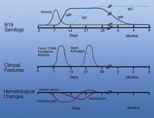 Time course of events following B19V infection. Professional illustration by Marie Dauenheimer.