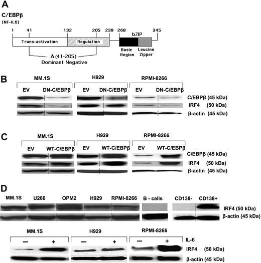 Figure 2. Regulation of IRF4 by C/EBPβ. (A) The human WT-C/EBPβ (also known as NF-IL6) cDNA is depicted as well as the region (an Spl1 fragment encoding amino acids 41-205) deleted to generate the DN-C/EBβ cDNA. These cDNAs inserted into empty vector (EV) pCDNA3.1 were used for the transfection studies. Transfection of the WT-C/EBPβ cDNA in MM cells results in overexpression. MM cell lines, MM.1S, H929, and RPMI-8266, were transfected with the EV, (B) DN-C/EBPβ, or (C) WT-C/EBPβ followed by G418 (500 μg/mL) selection for 10 days. Transfected MM cells were selected, and expression of C/EBPβ and IRF4 was detected by Western blotting with anti-C/EBPβ and anti-IRF4 antibody. β-Actin was used as a loading control. (D top panel) Expression of IRF4 in MM cell lines and primary MM cells was detected by Western blotting as described in “Western blot analysis.” (D bottom panel) Cells were cultured in 1% FBS with or without IL-6 for 48 hours, and analyzed for induction of IRF4 protein expression. β-Actin was used as a loading control for all samples. Vertical lines have been inserted to indicate a repositioned gel lane.
