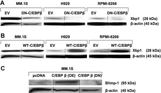 Figure 3. C/EBPβ regulates IRF4-dependent transcription factors such as XBP1 and BLIMP1. MM cells were transfected with EV, (A) DN-C/EBPβ, or (B) WT-C/EBPβ. Transfected cells were selected for 10 days by G418 (500 μg/mL). The selected cells were analyzed for expression of XBP1 by Western blotting with the anti-XBP1 antibody. (C) EV- and WT-C/EBPβ–transfected and selected cells were analyzed for the protein expression of BLIMP1. β-Actin was used as a loading control. Vertical lines have been inserted to indicate a repositioned gel lane.