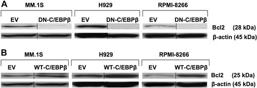 Figure 5. BCL2 is regulated by C/EBPβ. MM cells were transfected with EV, (A) DN-C/EBPβ, or (B) WT-C/EBPβ. Transfected cells were selected for 10 days with G418 (500 μg/mL). Lysates of transfected cells were subjected to Western blotting using anti-BCL2 antibody. β-Actin was used as a loading control. Vertical lines have been inserted to indicate a repositioned gel lane.