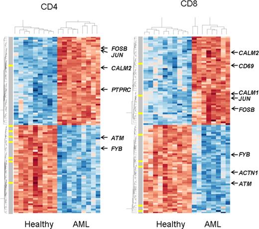 Figure 2. Supervised analysis: AML versus healthy T cells. Heatmap created using the top 50 most significantly up- and down-regulated genes for CD4 and for CD8 in the comparison of AML versus healthy cells. Up-regulated genes are in red and down-regulated, in blue. The yellow bars on the gray vertical bar highlight genes that were also found to be differentially expressed in the CLL versus healthy cell experiment. Labeled genes are those involved in T-cell activation or signaling or with actin polarization.
