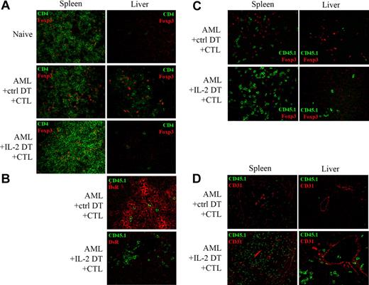 Figure 7. Treg depletion by IL-2DT treatment augments CTL infiltration into sites of AML metastases. AML-bearing mice were treated with IL-2DT or control DT (1 μg/dose) 4 and 13 days after tumor injection. Congenic B6-Ly5.2 (CD45.1+) CTLs (30 × 106/dose) were then injected intravenously 14 days after tumor injection and organs were harvested 6 days after CTL infusion. Confocal microscopy was performed. Naive B6 mice were used as normal tissue controls. (A) CD4 (green) and Foxp3 (red); (B) CD45.1 (green) and DsR (red); (C) CD45.1 (green) and Foxp3 (red); and (D) CD45.1 (green) and CD31 (red). Representative data from 1 of 2 similar experiments are shown.