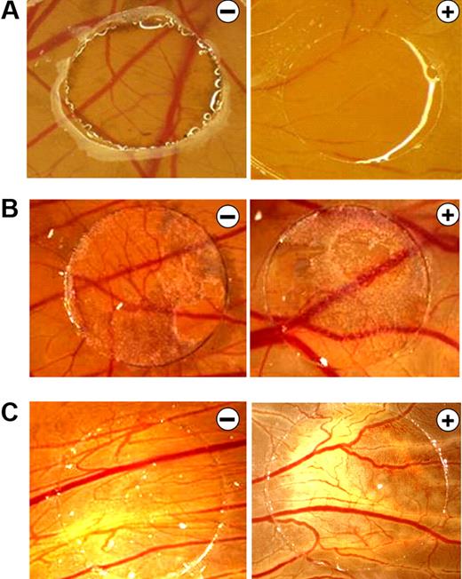 Figure 1. B16F10 melanoma supernatants neutralize the antiangiogenic effects of bortezomib in the CAM assay. (A) CAMs of 4-day-old chickens were incubated for 72 hours with control solution (−) or 0.1 ng of bortezomib/ring (+). Treatment with bortezomib inhibited CAM vascularization. (B) B16F10 melanoma xenografts were cultivated on the CAM for 5 days and treated daily with control solution (−) or 10 ng of bortezomib (+). Even at this high concentration, bortezomib had no antiangiogenic effects. B16F10 xenografts have a dark color. (C) CAMs were stimulated for 72 hours with supernatants of B16F10 melanoma cells in the presence of control solution (−) or 10 ng of bortezomib (+). Again, even at this high concentration, bortezomib had no antiangiogenic effects. Original magnification ×10. Images were acquired using an Olympus SZX10 stereomicroscope (2×/0.2 NA objective) with an Olympus E410 digital camera.