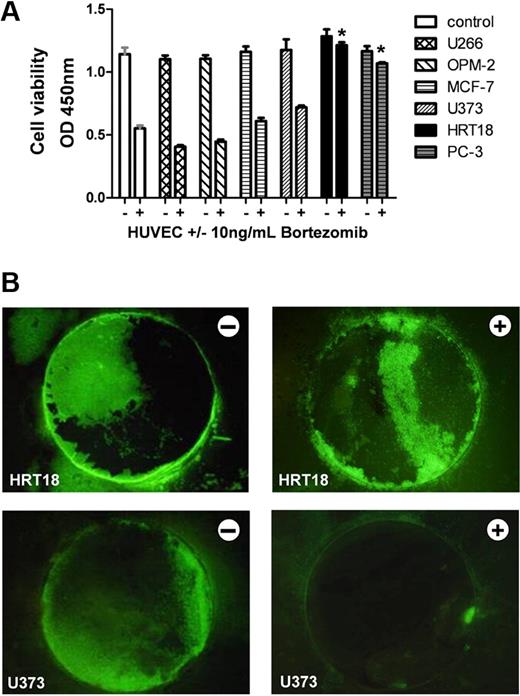 Figure 2. Screening for human tumor cell supernatants that block the antiangiogenic activity of bortezomib. (A) HUVECs were incubated with either control solution (−) or 10 ng/mL bortezomib (+) in the presence of the respective tumor cell culture supernatant. Cell viability was determined after 24 hours in a WST-1 assay monitoring the mitochondrial succinate reductase activity at 450 nm. Cells in standard culture medium served as control. Among the analyzed cell lines were: myeloma (U266 and OPM-2), breast carcinoma (MCF-7), glioblastoma (U373), colorectal cancer (HRT-18), and prostate carcinoma (PC-3). Bars represent mean ± SEM. *P < .05. (B) Growth and vascularization of human tumor xenografts in the CAM assay. Bortezomib-sensitive glioblastoma (U373) and bortezomib-resistant colorectal cancer (HRT-18) cells with stable overexpression of GFP were grown on the CAM for 2 days. Then xenografts were treated daily with control solution (−) or with 5 ng/mL bortezomib (+). After 3 days, tumors were analyzed under the fluorescence stereomicroscope to visualize GFP-positive tumor cells on the CAM. Bortezomib displayed marked antitumor effects against U373 but not against HRT-18 xenografts on the CAM. Original magnification ×10. Images were acquired using an Olympus SZX10 stereomicroscope (2×/0.2 NA objective) with an Olympus E410 digital camera.