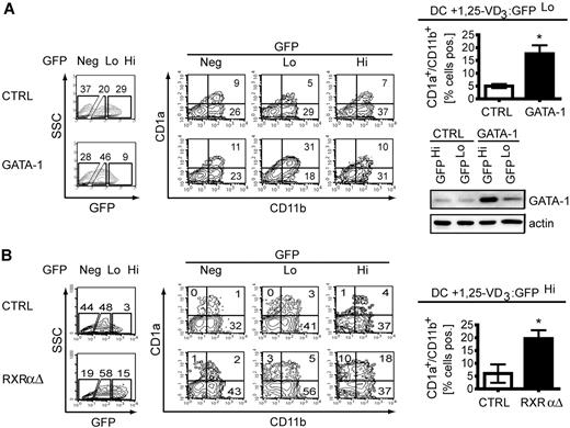 Figure 5. GATA-1 induction mimics VDR-signal inhibition in reestablishing DC development in the presence of 1.25-VD3. CD34+ cells were transduced with GATA-1-IRES-GFP, RXRαΔ-IRES-GFP, or empty vector control. Forty-eight hours after transduction, cells were plated in cultures supplemented with LC-promoting cytokines in the presence of 62.5 nmol/L 1.25-VD3 for 7 days. GFPneg, GFPlo, and GFPhi cells were separately gated and were analyzed for CD1a and CD11b expression. Bar diagrams represent mean percentages (± SEM) of CD1a+ CD11b+ cells in gene-transduced populations as indicated. Each number in a quadrant represents the percentage of cells in the quadrant. (A) GATA-1 versus control vector, n = 5; (B) RXRαΔ versus control vector, n = 3. Western blot shows GATA-1 and actin expression of GFPlo versus GFPhi GATA-1-IRES-GFP–transduced cells sorted by FACS. Data are representative of 3 independent experiments.