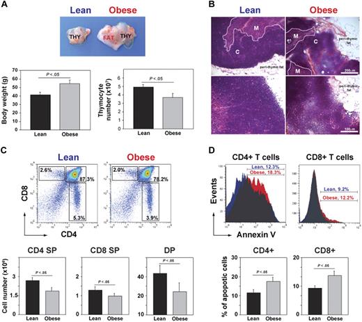 Figure 1. DIO induces thymic involution. (A) Compared with chow-fed control male mice, the thymus appeared “fatty” in age-matched 13-month-old DIO animals along with increased body weight and reduced total thymic cell numbers (n = 12 per group). (B) The hematoxylin and eosin–stained sections of 13-month-old control and DIO mice showed increased perithymic fat and obliteration of CMJ. (C) FACS analysis of CD4-FITC– and CD8-PE–stained thymocytes. The 13-month-old DIO mice had significant reduction in SP CD4 (bottom right quadrant) and CD8 (top left quadrant) and in double-positive cells (top right quadrant). (D) The annexin-V staining on CD4 SP and CD8 SP cells showed a statistically significant (P < .05) increase in the frequency of apoptosis. Data are expressed as mean ± SEM from 8 to 12 mice per group. Images were acquired using Zeiss Axioskope microscope (10× and 20× objectives) and Axiovision Rel 4.6 software.