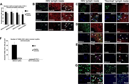 Figure 3. Close contact between TRAIL-expressing pDCs and apoptotic T cells in lymph nodes of patients infected with HIV-1. (A) A quantitative analysis of pDCs in lymph nodes of viremic patients infected with HIV-1 (n = 8) and controls (n = 5) was performed by immunofluorescence staining with an anti–BDCA-2 mAb combined with anti–HLA-DR, anti-CD45RA, or anti-CD123 mAbs. The quantity of TRAIL-expressing pDCs was analyzed by anti-TRAIL/anti–BDCA-2 staining. Data are given as absolute numbers of double-positive cells per square millimeter ± SEM. (B) Representative views of anti–BDCA-2/anti–HLA-DR, anti–BDCA-2/anti-CD45RA, and anti–BDCA-2/anti-CD123 stainings of a lymph node of a viremic patient infected with HIV-1. Arrows denote double-positive pDCs. (C-E) Immunofluorescence triple labeling of lymph nodes of patients infected with HIV-1 and HIV-1–seronegative controls with (C) TUNEL (FITC), anti-CD4 (TRITC), and anti–BDCA-2 (Cy5); (D) TUNEL (FITC), anti-CD3 (TRITC), and anti–BDCA-2 (Cy5); or (E) TUNEL (FITC), anti-TRAIL (TRITC), and anti–BDCA-2 (Cy5) showed BDCA-2+, TRAIL-expressing pDCs surrounded by apoptotic T cells in HIV-1 lymph nodes. Arrows denote BDCA-2+ pDCs. (F) To quantify the proximity of pDCs or monocytes to apoptotic T cells, the contacts of BDCA-2+ or CD14+ cells to TUNEL+CD3+ cells were enumerated in lymph nodes of HIV-infected patients and healthy controls. The data are given as absolute numbers of indicated cells in contact to apoptotic T cells ± SEM. (G) Immunofluorescence triple labeling of lymph nodes of viremic patients infected with HIV-1 with TUNEL (FITC), anti-TRAIL R1, or anti-TRAIL R2 (TRITC) and anti-CD3 (APC) denotes apoptotic T cells as TRAIL R1–expressing and TRAIL R2–deficient cells. Arrows denote triple-positive cells. (B-E,G) Original magnification ×400. Pictures were recorded with a Zeiss Axiovert 200M microscope (40×/1.30 oil objective), a HAL100 camera, and LSM510 software (release 3.0, update 3.2) in a 1024 × 1024 solution.