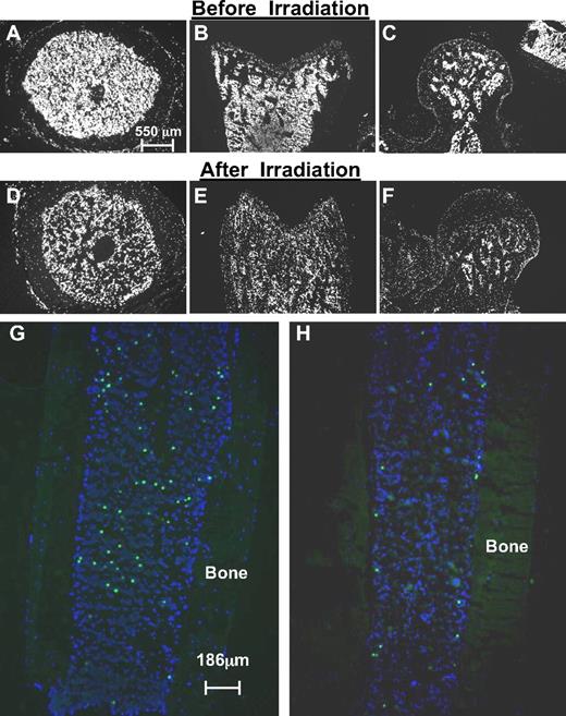 Figure 2. Analysis of transplanted hematopoietic cells in nonirradiated and irradiated bone marrow. (A-F) Cross-sections of nonirradiated (A-C) and irradiated (D-F) bones illustrate the markedly reduced cell density after irradiation (DAPI). Shown are transverse sections of femur shafts (A,D) and longitudinal sections of distal femoral epiphyses (B,E) or femoral heads (C,F). (G-H) Differential distribution of transplanted hematopoietic stem/progenitor cells in nonirradiated (G) and irradiated (H) hosts. Shown here are longitudinal sections of tibiae not used for counting from recipients of similar numbers of donor cells. The efficiency of homing in nonirradiated hosts is higher than in irradiated hosts, but the distribution follows a random pattern, whereas in irradiated hosts, transplanted cells preferentially home to endosteal regions within compact bone. Corresponding quantitative data, generated in transverse sections of femurs, are shown in Table 1.