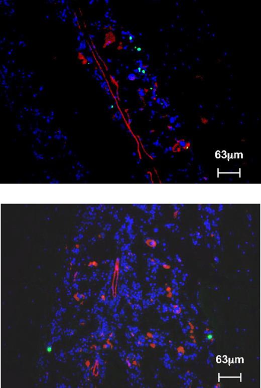 Figure 6. Microanatomic distribution of normal donor cells in irradiated Sl/Sld recipients. Transplanted HSCs display a qualitatively similar preferential lodging to endosteal regions in irradiated Sl/Sld recipients (blue: DAPI, green: CFSE-labeled wild-type HSCs, red: anti-CD31, top panel: tibia, bottom panel: femur), as normal cells do.