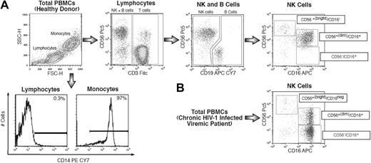 Figure 1. Strategy of NK-cell gating within total freshly purified PBMCs. (A) Within the lymphocyte gate of freshly purified PBMCs, NK-cell subsets were separated from CD14+ (monocytes), CD3+ (T lymphocytes), and CD19+ (B lymphocytes), and then characterized for CD56 and CD16 surface expression. (B) Representative flow cytometric example of expansion of CD56−/CD16+ NK-cell (lower right) subset from a chronic viremic HIV-1–infected patient.