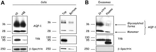 Figure 2. AQP-1 is released in association with exosomes during in vitro maturation of reticulocytes and in vivo. (A) Reticulocytes (106 cells) before (t0) and after 48 hours (t48) in vitro maturation (left); top and bottom fractions were collected after cell separation on a Percoll gradient (right) were subjected to SDS-PAGE, followed by immunoblotting for the proteins indicated. (B) Exosomes (50 μg protein) released during in vitro maturation (left lane) or isolated directly from the plasma of anemic mice (right lane) were subjected to SDS-PAGE, followed by immunoblotting for the proteins indicated.