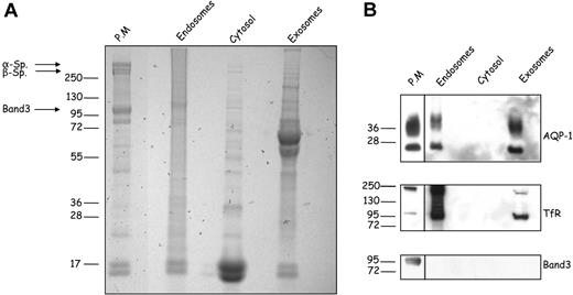 Figure 3. Subcellular localization of reticulocyte AQP-1. Constituents of mouse reticulocytes were fractionated after lysis as described in “Methods.” The various fractions (50 μg protein), plasma membrane, endosomes, cytosol, and exosomes were separated by SDS-PAGE and (A) stained with Coomassie Blue or (B) immunoblotted for the proteins indicated. Arrows indicate cytoskeleton proteins present in the mature red cell plasma membrane. Blots of plasma membrane fraction were exposed for a shorter period of time than those of the other 3 samples as indicated by the solid lines.