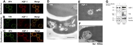 Figure 4. A part of the pool of AQP-1 colocalizes with the TfR and is found in multivesicular endosomes in reticulocytes. After purification by Percoll gradient, reticulocytes (A-B) and red blood cells (C) were fixed with acrolein and deposited on cover slips pretreated with poly-l-lysine. After permeabilization (Triton X-100), the cells were immunostained for GPA (green) and AQP-1 (red) (A,C), or TfR (green) and AQP-1 (red) (B). The slides were examined in a confocal microscope (Zeiss LSM 510 META camera, Zeiss Plan Apochromat 100×/1.4 NA oil objective, scan zoom 2.0) and pictures acquired and processed with Zeiss Laser Scanning Microscope LSM 510 software, Version 3.2 SP2. For visualization of TfR and AQP-1 in multivesicular endosomes and exosomes, reticulocytes were fixed with a mixture of paraformaldehyde, glutaraldehyde, and sucrose. After dehydration and embedding, thin sections of cells were mounted on nickel grids, blocked, and then immunostained for the TfR (D) or AQP-1 (E-F). Sections were examined in a Philips-410 electron microscope equipped with AMT XR41 Biological 2k side-mounted CCD camera, and images were acquired with AMT600 software and analyzed with Photoshop CS (Adobe Systems). After treatment with dynasore 80 μM or the solvent, DMSO, alone for 20 hours (G), 106 cells (left) and exosomes, resuspended in the same volume of Laemmli buffer,23 (right) were examined by SDS-PAGE and immunoblotting for the proteins indicated.